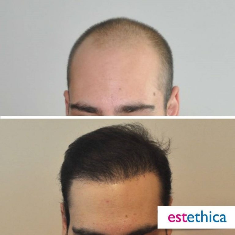 Before-After-17.jpg