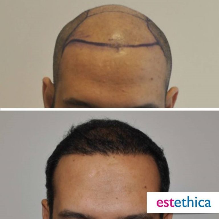 Before-After-18.jpg