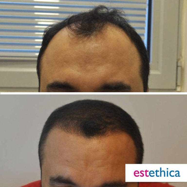 Before-After-19.jpg