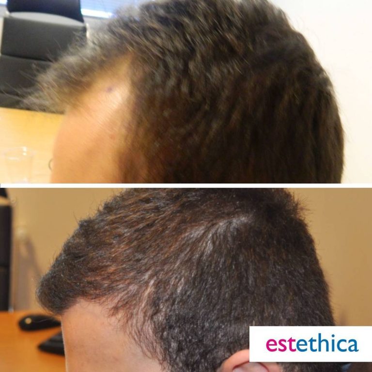Before-After-20.jpg
