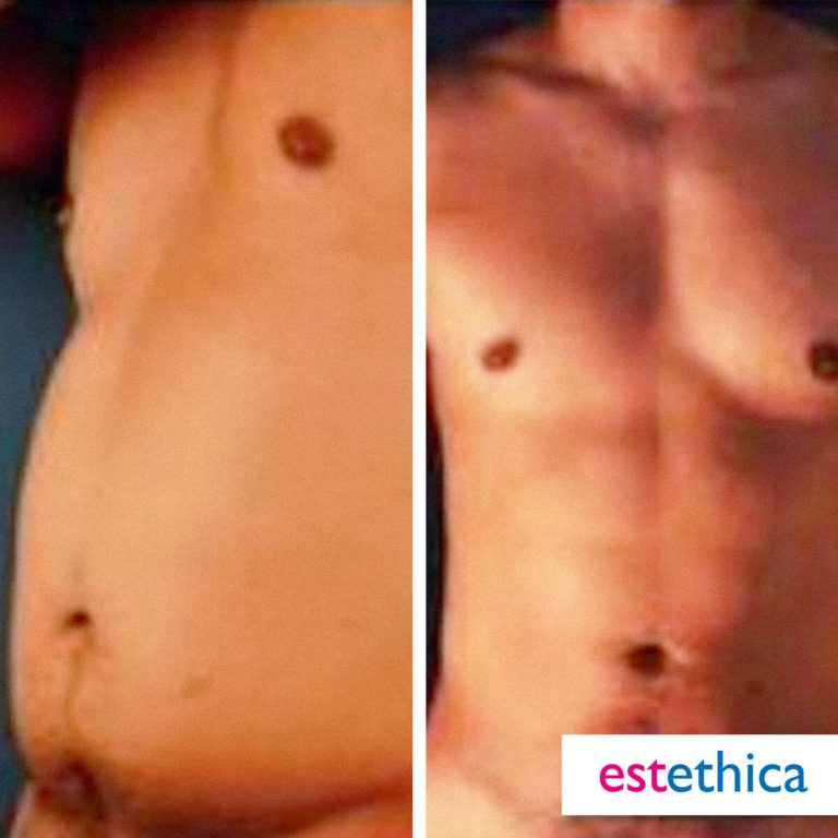 Gorsel_6-2.jpg